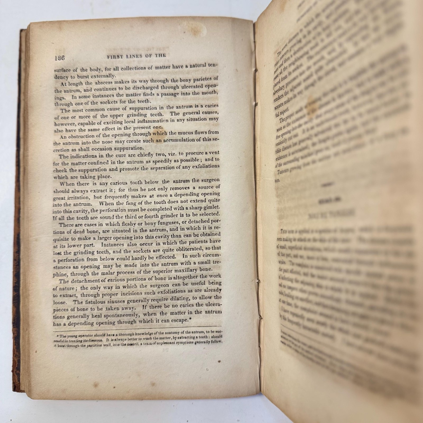 First Lines of the Practice of Surgery. Being an Elementary Work for Students, and a Concise Book of Reference for Practitioners. In Two Parts. Part I: General Surgical Subjects. Part II: Particular Surgical Subjects, With Plates. — photograph 7.
