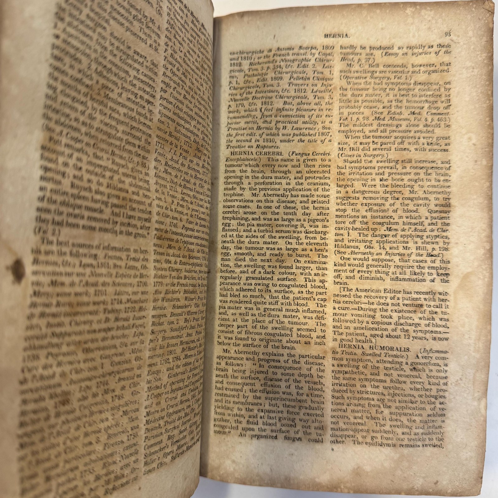Dictionary of Practical Surgery, containing a complete exhibition of the present state of the principles and practice of Surgery, collected From the best and most original sources of information, and illustrated by critical remarks. — photograph 9.