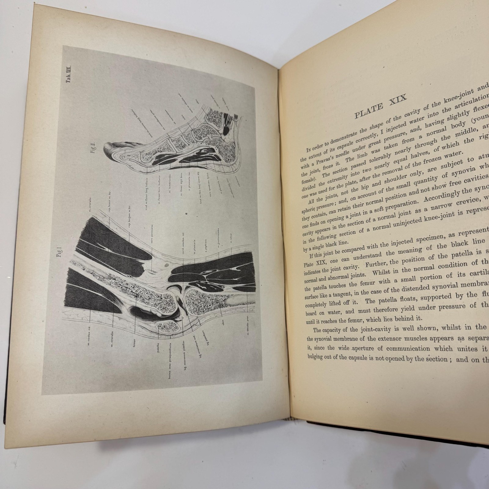 An Atlas of Topographical Anatomy After Plane Sections of Frozen Bodies by Wilhelm Braune and Edward Bellamy (Trans.), 1877 — photograph 10.