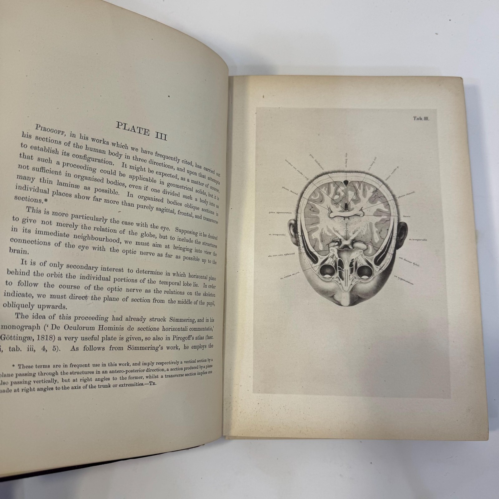 An Atlas of Topographical Anatomy After Plane Sections of Frozen Bodies by Wilhelm Braune and Edward Bellamy (Trans.), 1877 — photograph 5.