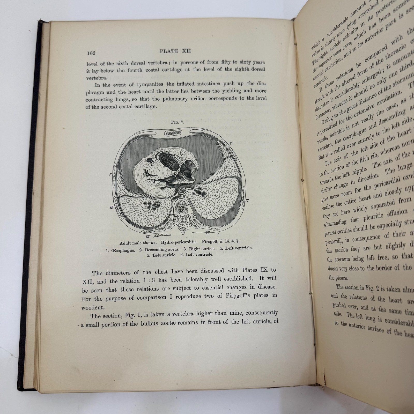 An Atlas of Topographical Anatomy After Plane Sections of Frozen Bodies by Wilhelm Braune and Edward Bellamy (Trans.), 1877 — photograph 6.