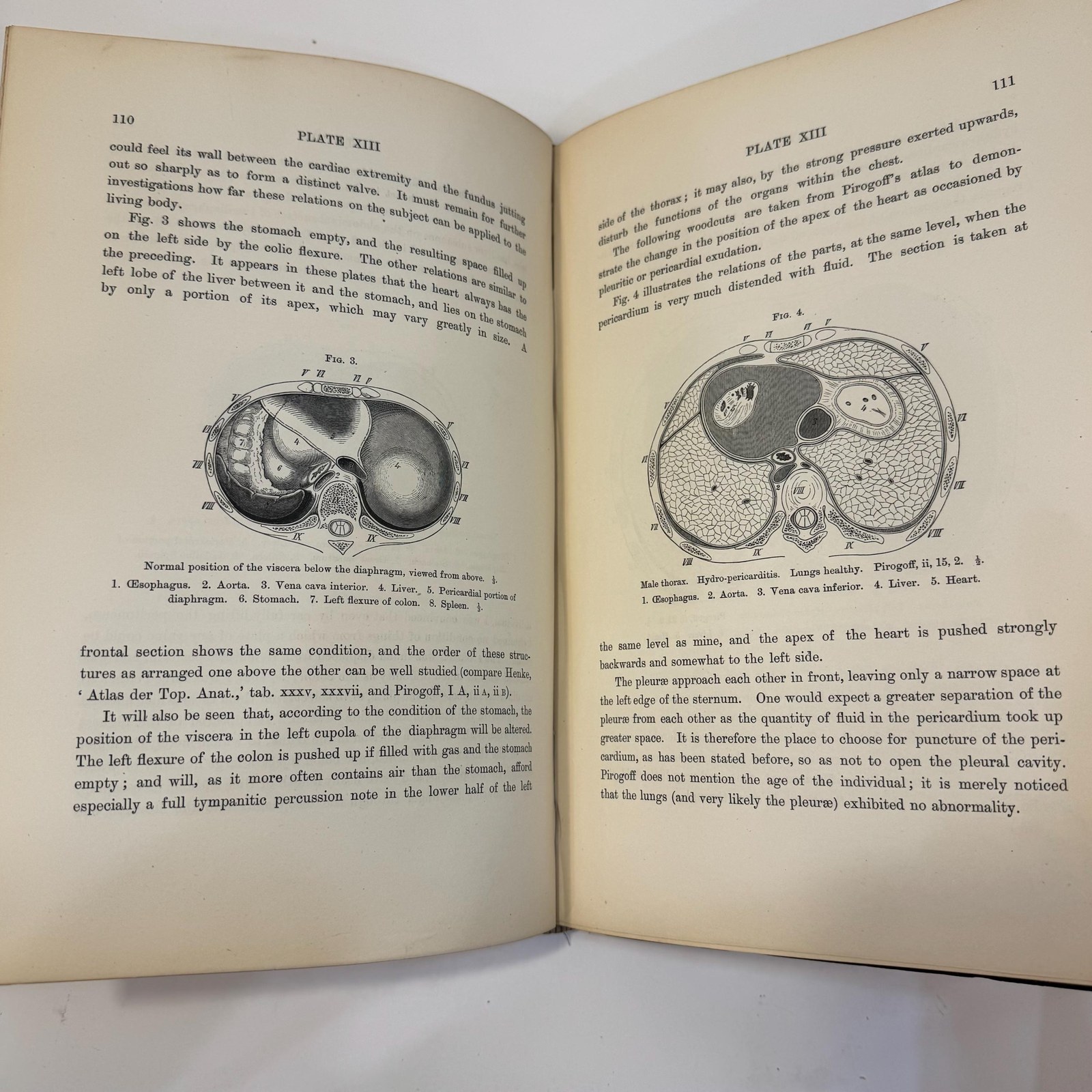 An Atlas of Topographical Anatomy After Plane Sections of Frozen Bodies by Wilhelm Braune and Edward Bellamy (Trans.), 1877 — photograph 7.