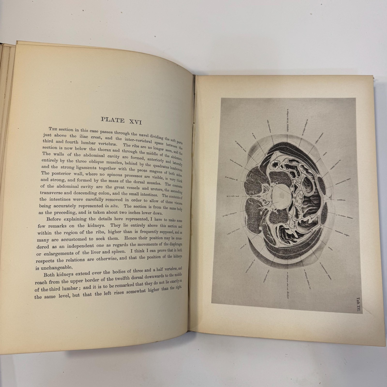 An Atlas of Topographical Anatomy After Plane Sections of Frozen Bodies by Wilhelm Braune and Edward Bellamy (Trans.), 1877 — photograph 8.