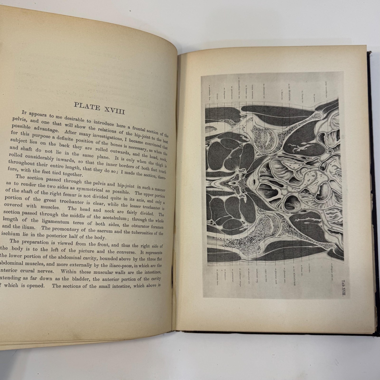 An Atlas of Topographical Anatomy After Plane Sections of Frozen Bodies by Wilhelm Braune and Edward Bellamy (Trans.), 1877 — photograph 9.