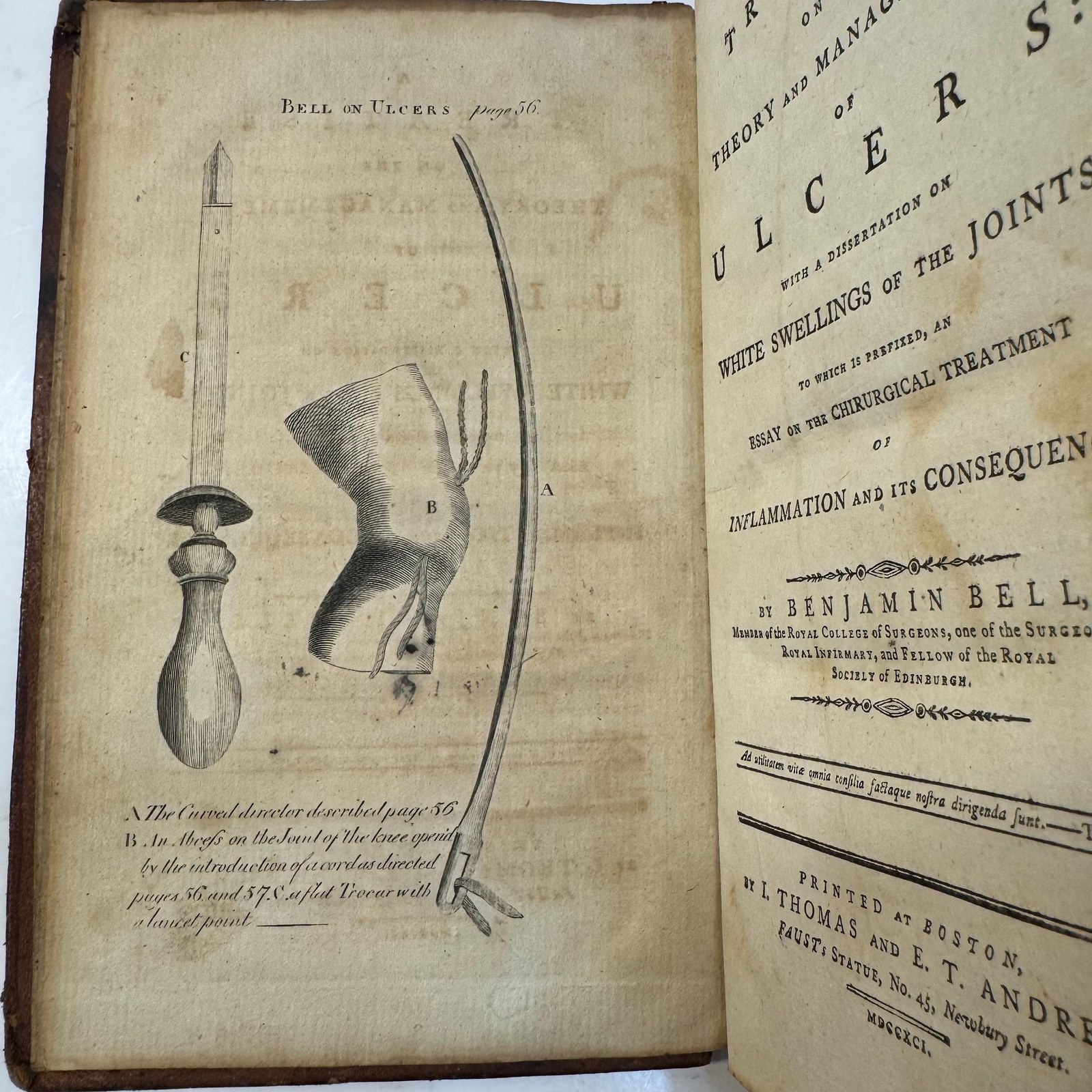 Treatise on the Theory and Management of Ulcers: with a Dissertation on White Swellings of the Joints. — photograph 3.