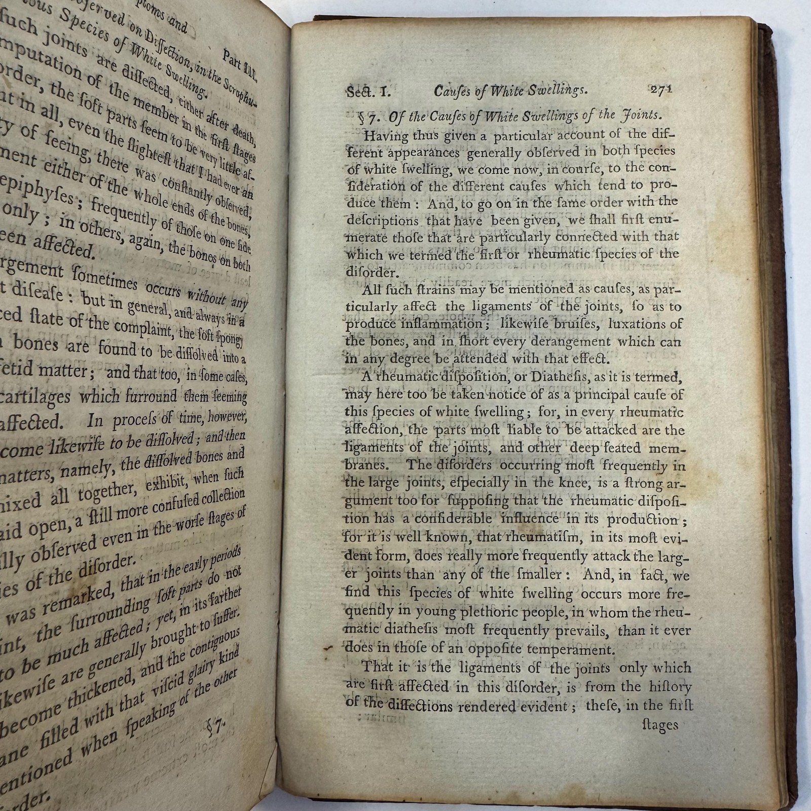 Treatise on the Theory and Management of Ulcers: with a Dissertation on White Swellings of the Joints. — photograph 8.