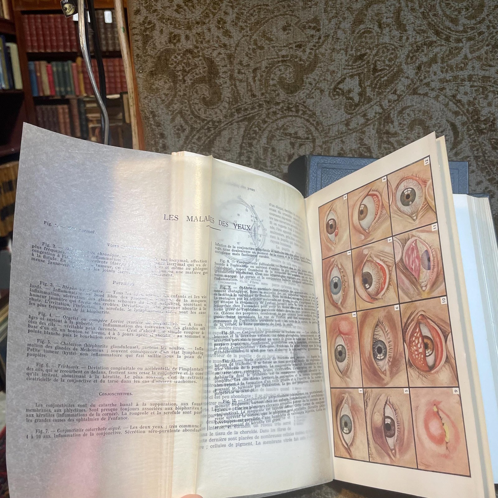 Docteur M. Laurre, Mon Médecin Nouvelle Encyclopédie Pratique de Médecine et d'Hygiène, Vols. I, II Translated: Dr. M. Laurre, My Doctor New Practical Encyclopedia of Medicine and Hygiene Vols. I, II — photograph 8.