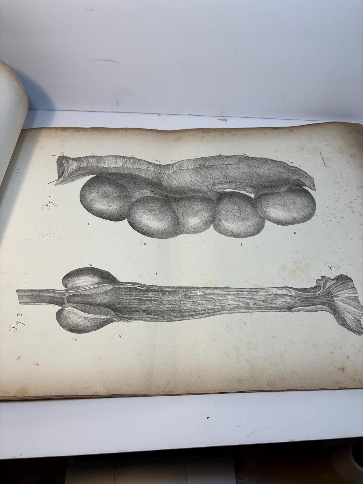 Atlas only of Illustrations of Some of the Principal Diseases of The Ovaria, Their Symptons and Traetment — photograph 2.