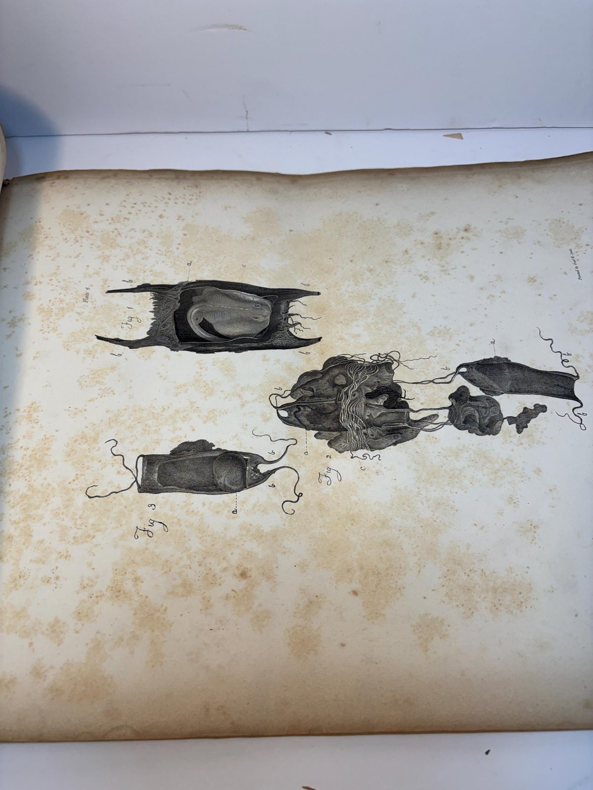 Atlas only of Illustrations of Some of the Principal Diseases of The Ovaria, Their Symptons and Traetment — photograph 4.