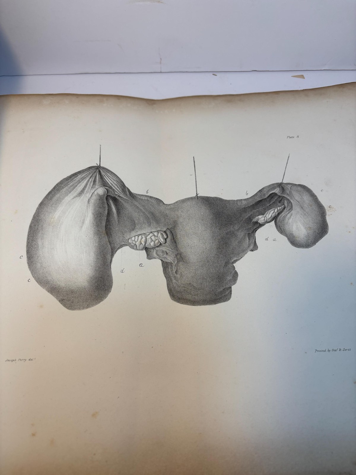 Atlas only of Illustrations of Some of the Principal Diseases of The Ovaria, Their Symptons and Traetment — photograph 6.