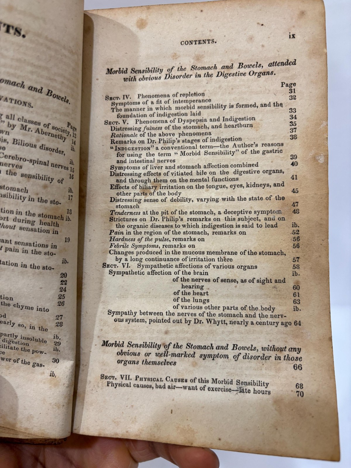An Essay on Indigestion; Or Morbid Sensibility of The Stomach and Bowels, as The Proximate Cause or Characteristic Condition of Dyspepsy, Nervous Irritability, Mental Despondency, Hypochondriasis, and Many Other Ailments of Body and Mind. To Which are Added, Observtions on the Diseases & Regimen of Invalids on Their Return from Hot and Unhealthy Climates. Third Philadelphia, From the Sixth London Edition, Much Enlarged. — photograph 6.