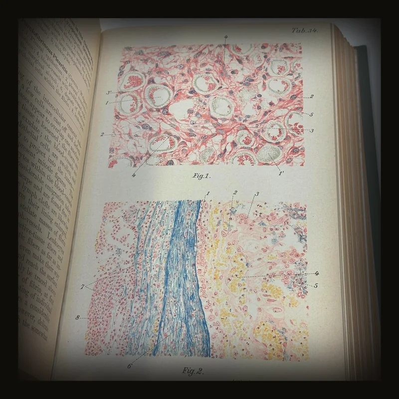 Atlas and Epitome of General Pathologic Histology, Authorized Translation from The German, With 176 Colored Illustrations on 80 Lithographic Plates and 36 Figures in Black and Colors.