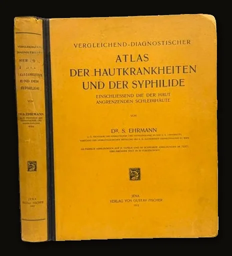 Vergleichend-Diagnostischer Atlas der Hautkrankheiten und der Syphilide, Einschliessend die der Haut Angrenzenden Schleimhäute. 312 Farbige Figuren auf 91 Tafeln und 191 Schwarze Abbildungen im Text; Erklärender Text in 29 Vorlesungen. Translated: Comparative Diagnostic Atlas of Diseases of the Skin and Syphilitic Diseases, Including the Mucous Membranes Adjoining the Skin. With 312 Colored Figures on 91 Plates and 191 Black-and-White Illustrations in the Text; Explanatory Text in 29 Lectures. First Edition..