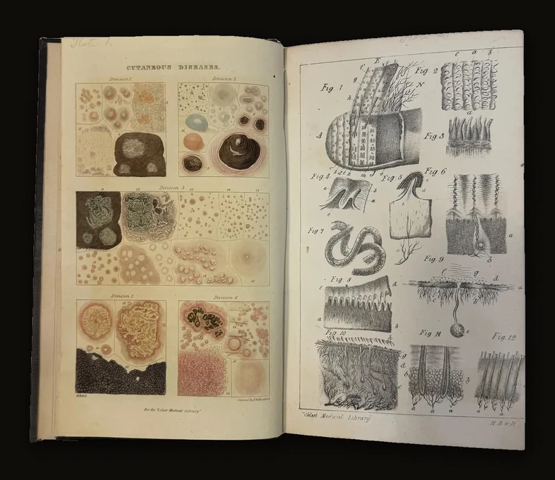 A Practical Treatise on The Diseases of The Skin by Samuel Plumbe, 1837 | Revised & Enlarged Edition.