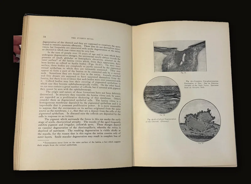 Diagnostics of The Fundus Oculi by Dr. Edward L. Oatman, 1926 | Three Volumes with Illustrations, Stereograms, Diagnostic Cards..