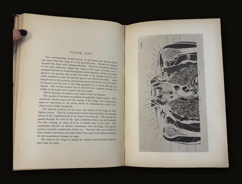 An Atlas of Topographical Anatomy After Plane Sections of Frozen Bodies by Wilhelm Braune and Edward Bellamy (Trans.), 1877.