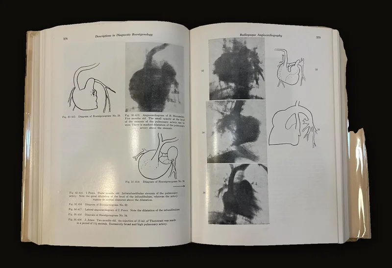 Classic Descriptions in Diagnostic Roentgenology by Andre J. Bruwer, 1964 | Two Volumes.