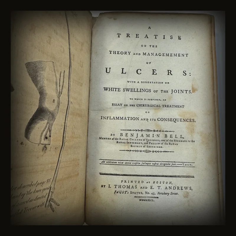 Treatise on the Theory and Management of Ulcers: with a Dissertation on White Swellings of the Joints..
