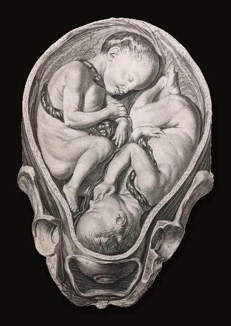 A Set of Anatomical Tables with Explanations, and a Abridgment, of the Practice of Midwifery, With a View to Illustrate a Treatise on That Subject, and Collection of Cases. The Second Edition, Corrected..