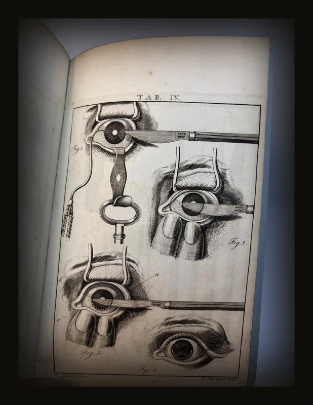 A Treatise on the Extraction of The Cataract [Presentation Copy] Unbound.