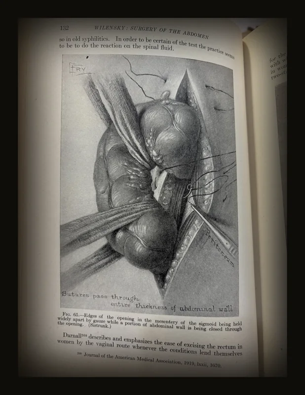 Progressive Medicine, 1920. A Quarterly Digest of Advances, Discoveries and Improvements in The Medical and Surgical Sciences..