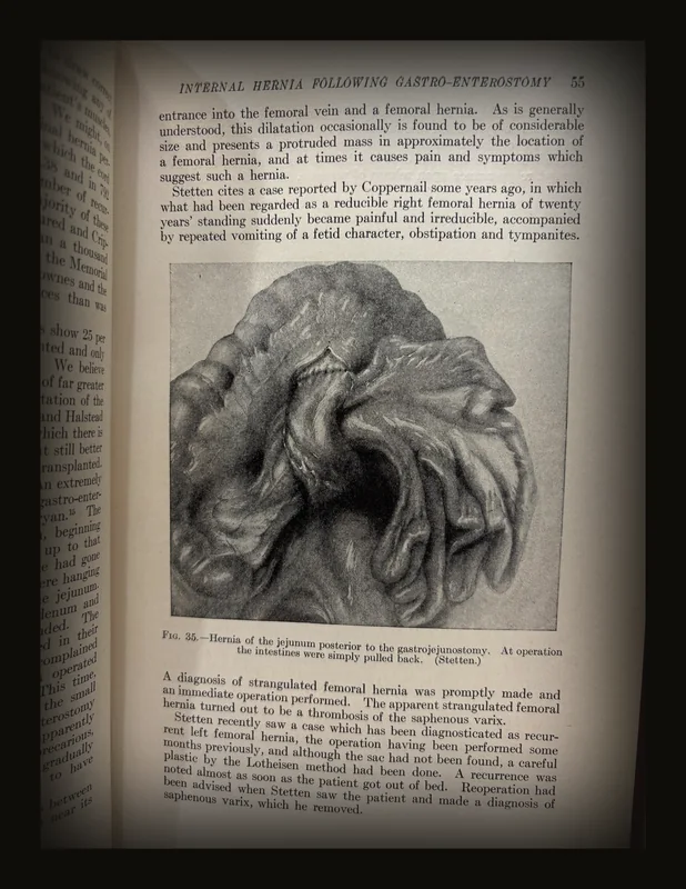 Progressive Medicine, 1921. A Quarterly Digest of Advances, Discoveries and Improvements in The Medical and Surgical Sciences..