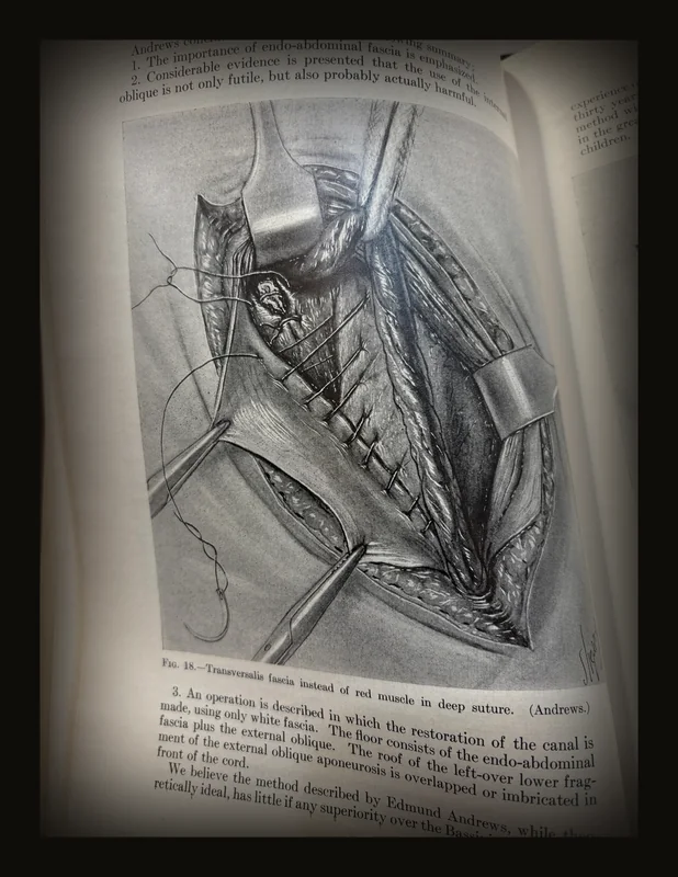 Progressive Medicine, 1925. A Quarterly Digest of Advances, Discoveries and Improvements in The Medical and Surgical Sciences..